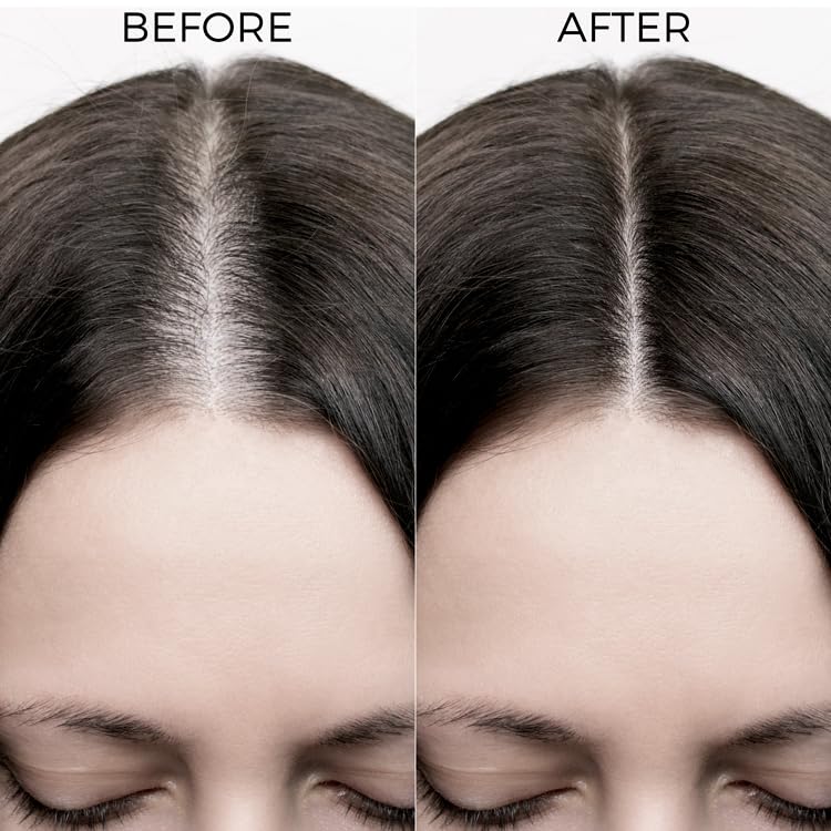 Brillare 20% Rosemary Oil Shots For Rapid Hair Growth | Improves Thickness | Controls Hair Fall & Nourishes Scalp | 100% Natural, Non Greasy Hair Oil Shots For Men & Women image 5