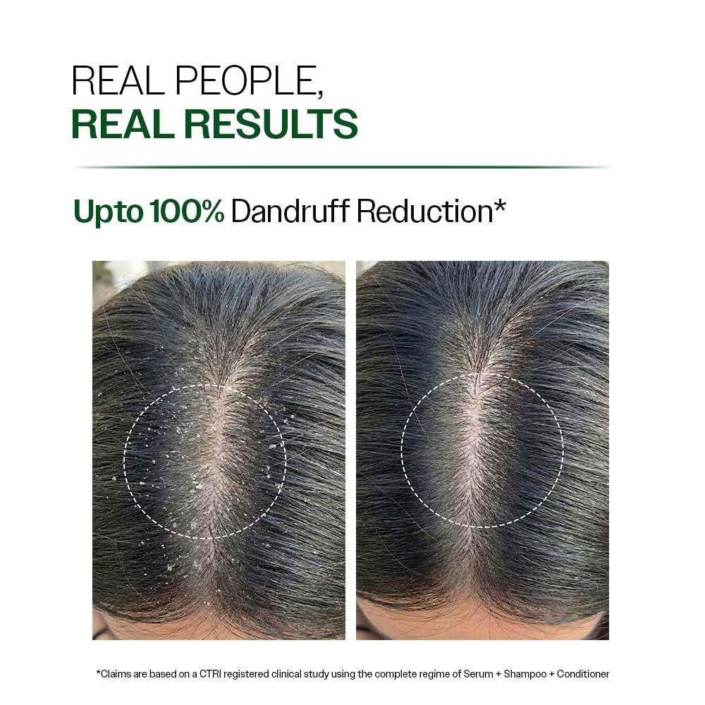 Bare Anatomy Anti-Dandruff Shampoo | Up To 100% Dandruff Reduction | ZPTO-Free | pH 5.3 | Salicylic Acid, Piroctone Olamine & Biotin | Non-Drying Formula | For Strong, Smooth Hair | Unisex | 100 ml image 4